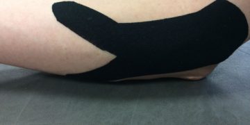 Using Kinesiology Tape To Reduce Injury And Improve Recovery