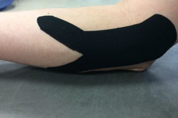 Using Kinesiology Tape To Reduce Injury And Improve Recovery